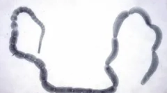 Parazit cucumber chain: symptomy a léčba